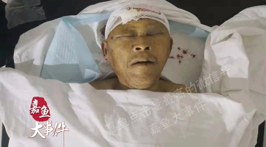 2025新澳门正版新澳免费资本和游客意大利车祸身亡与意大利车祸新闻