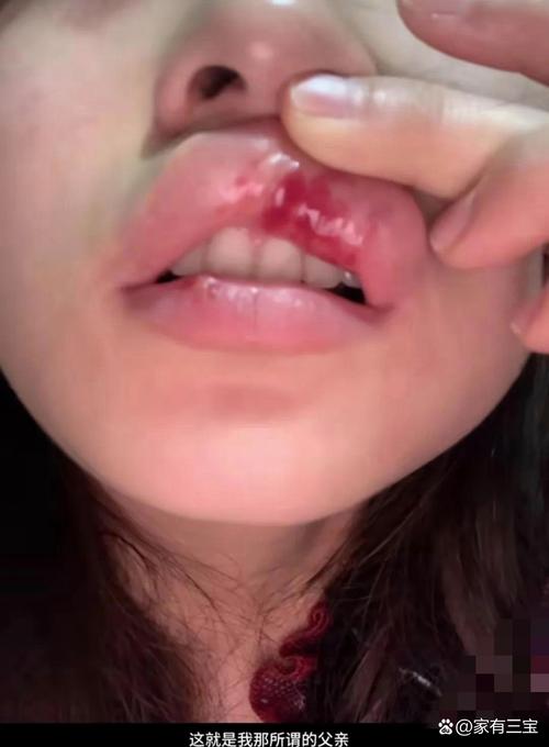 新奥精准数据免费开放和父母殴打女儿出气与父母殴打女儿出气：用刀刮 吊起来打